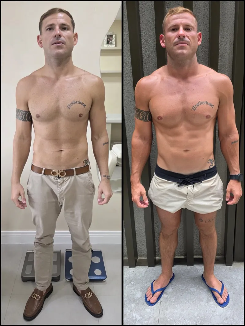 Antes e depois de paciente do Pedro Dias